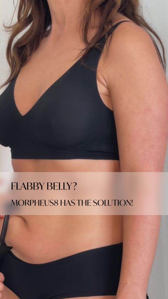 Say Goodbye to a Flabby Belly with Morpheus8! 💫✨

Our patient struggled for years with loose skin on her stomach. Even after weight loss, no creams or workouts could restore firmness… until she discovered Morpheus8!

💉 How does it work?
Morpheus8 is a cutting-edge treatment that targets fat cells while simultaneously tightening and rejuvenating the skin. The result? A firmer, smoother, and more toned stomach—without surgery!

✅ Lifts and tightens saggy skin
✅ Stimulates collagen for long-lasting results
✅ Visible transformation after just one session

💡 If stubborn skin keeps you from feeling confident, Morpheus8 could be the game-changer you've been looking for! Ready for a sculpted, youthful look?

You can sign up for a consultation in BIO @aesthetics_clinic_geneva
Connect with us:
📍Geneva: Call +41 22 732 22 23 or WhatsApp at +41
79 931 20 66
📍Montreux: Call +41 79 908 98 98
📍Gstaad: Call +41 79 196 98 69

#BodyContouringGenève #RFGenève #MorpheusGenève #DermomaskGenève #FatLossGenève #SlimmingGenève #BodySculptingGenève #NonSurgicalContour #SkinTighteningGenève #FatReductionGenève #BeautyTreatmentsGenève #CelluliteTreatmentGenève #StretchMarksGenève #StretchMarksTreatmentGenève #StretchMarksRemovalGenève ##drtenorio 
#aestheticsclinic